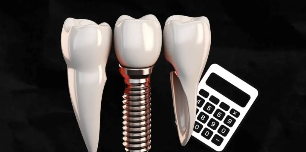Náklady na zubní implantáty v Turecku
